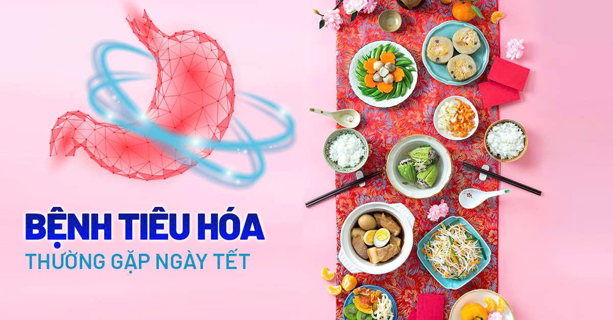 Phòng Ngừa Các Bệnh Tiêu Hóa Thường Gặp Trong Dịp Lễ Tết